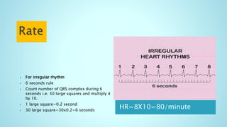 HR=8X10=80/minute
 For irregular rhythm
 6 seconds rule
 Count number of QRS complex during 6
seconds i.e. 30 large squares and multiply it
by 10.
 1 large square=0.2 second
 30 large square=30x0.2=6 seconds
 