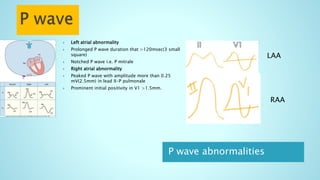 P wave abnormalities
 Left atrial abnormality
 Prolonged P wave duration that >120msec(3 small
square)
 Notched P wave i.e. P mitrale
 Right atrial abnormality
 Peaked P wave with amplitude more than 0.25
mV(2.5mm) in lead II-P pulmonale
 Prominent initial positivity in V1 >1.5mm.
LAA
RAA
 