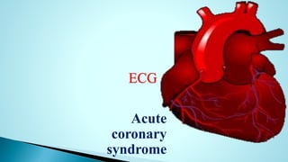 ECG
Acute
coronary
syndrome
 