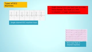 Single channel ECG machine trace
ECG trace from 3
channel machine
 Single channel ECG-one lead trace at a time.
 Three channel- four leads at a time
 12 channel- 12 leads simultaneously
 