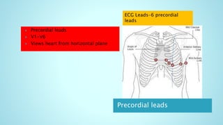 Precordial leads
 Precordial leads
 V1-V6
 Views heart from horizontal plane
 