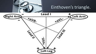 Einthoven’s triangle.
 