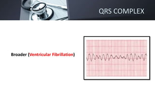 QRS COMPLEX
Broader (Ventricular Fibrillation)
 