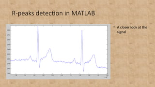 Ecg R Peak Detection | PPT