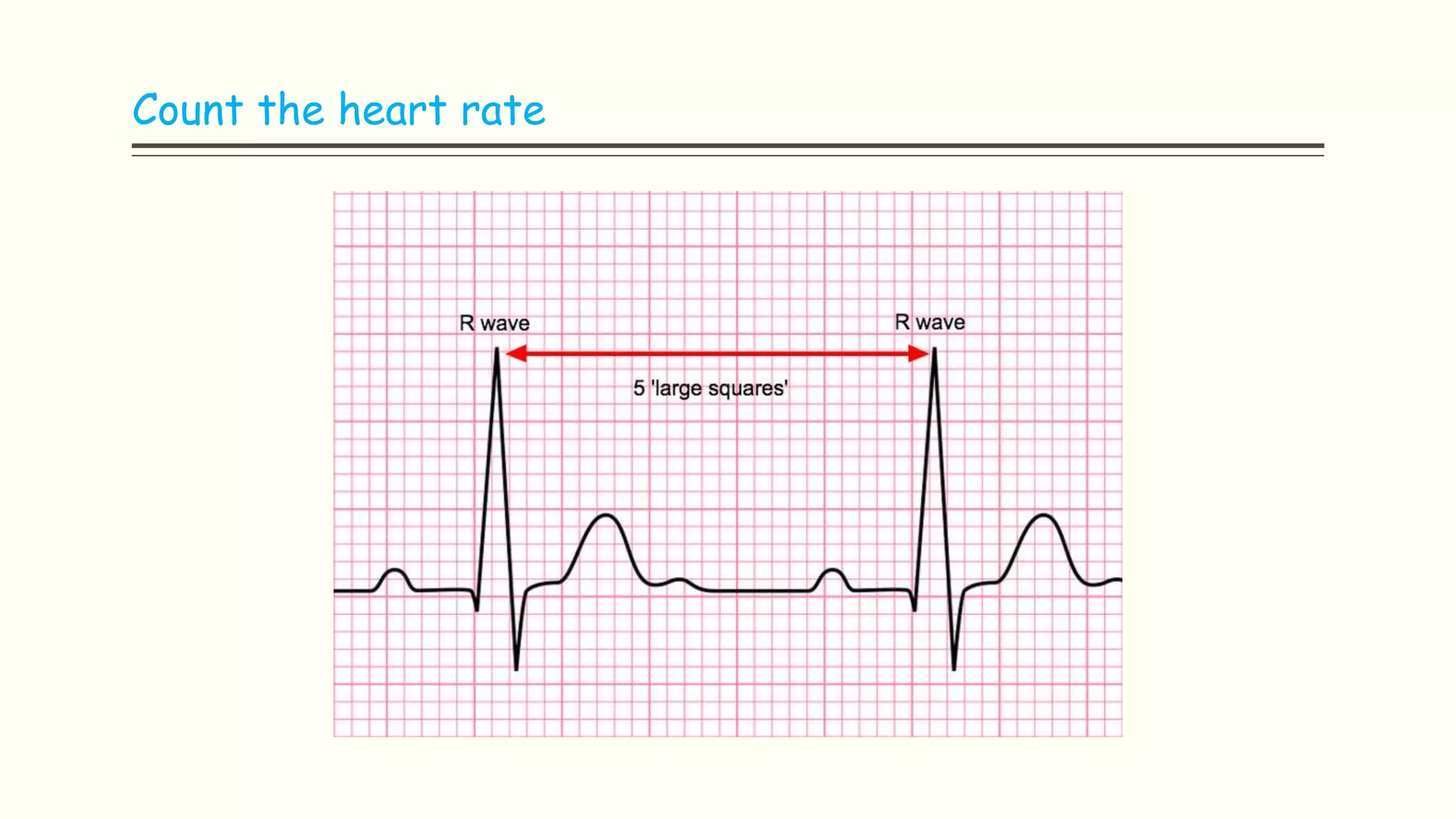 Ecg | PPTX