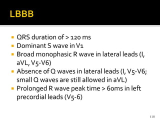  QRS duration of > 120 ms
 Dominant S wave inV1
 Broad monophasic R wave in lateral leads (I,
aVL,V5-V6)
 Absence of Q waves in lateral leads (I,V5-V6;
small Q waves are still allowed in aVL)
 Prolonged R wave peak time > 60ms in left
precordial leads (V5-6)
118
 