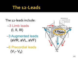 The 12-leads include:
132
–3 Limb leads
(I, II, III)
–3 Augmented leads
(aVR, aVL, aVF)
–6 Precordial leads
(V1- V6)
 