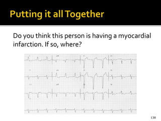 Do you think this person is having a myocardial
infarction. If so, where?
138
 