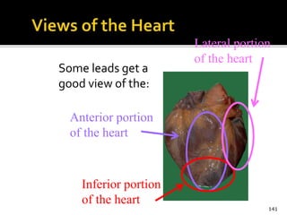 Some leads get a
good view of the:
141
Anterior portion
of the heart
Lateral portion
of the heart
Inferior portion
of the heart
 