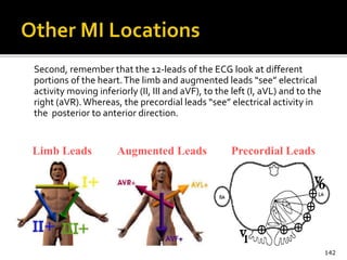 Second, remember that the 12-leads of the ECG look at different
portions of the heart.The limb and augmented leads “see” electrical
activity moving inferiorly (II, III and aVF), to the left (I, aVL) and to the
right (aVR).Whereas, the precordial leads “see” electrical activity in
the posterior to anterior direction.
142
Limb Leads Augmented Leads Precordial Leads
 