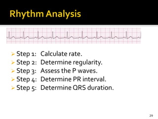  Step 1: Calculate rate.
 Step 2: Determine regularity.
 Step 3: Assess the P waves.
 Step 4: Determine PR interval.
 Step 5: DetermineQRS duration.
29
 