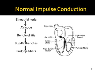 Sinoatrial node
AV node
Bundle of His
Bundle Branches
Purkinje fibers
4
 