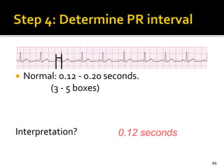  Normal: 0.12 - 0.20 seconds.
(3 - 5 boxes)
Interpretation?
46
0.12 seconds
 