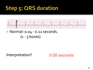  Normal: 0.04 - 0.12 seconds.
(1 - 3 boxes)
Interpretation?
47
0.08 seconds
 