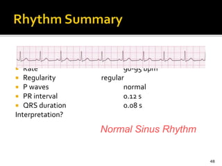  Rate 90-95 bpm
 Regularity regular
 P waves normal
 PR interval 0.12 s
 QRS duration 0.08 s
Interpretation?
48
Normal Sinus Rhythm
 