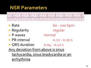  Rate 60 - 100 bpm
 Regularity regular
 P waves normal
 PR interval 0.12 - 0.20 s
 QRS duration 0.04 - 0.12 s
Any deviation from above is sinus
tachycardia, sinus bradycardia or an
arrhythmia
49
 