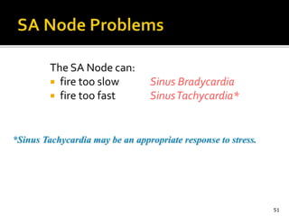 The SA Node can:
 fire too slow
 fire too fast
Sinus Bradycardia
SinusTachycardia*
51
*Sinus Tachycardia may be an appropriate response to stress.
 