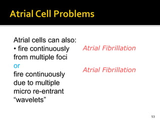 53
Atrial cells can also:
• fire continuously
from multiple foci
or
fire continuously
due to multiple
micro re-entrant
“wavelets”
Atrial Fibrillation
Atrial Fibrillation
 