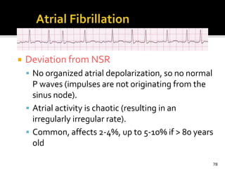  Deviation from NSR
 No organized atrial depolarization, so no normal
P waves (impulses are not originating from the
sinus node).
 Atrial activity is chaotic (resulting in an
irregularly irregular rate).
 Common, affects 2-4%, up to 5-10% if > 80 years
old
78
 