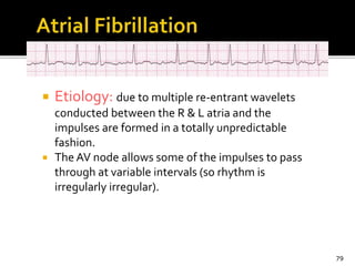  Etiology: due to multiple re-entrant wavelets
conducted between the R & L atria and the
impulses are formed in a totally unpredictable
fashion.
 The AV node allows some of the impulses to pass
through at variable intervals (so rhythm is
irregularly irregular).
79
 