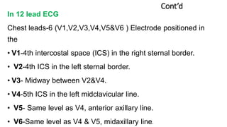 Cont’d
In 12 lead ECG
Chest leads-6 (V1,V2,V3,V4,V5&V6 ) Electrode positioned in
the
• V1-4th intercostal space (ICS) in the right sternal border.
• V2-4th ICS in the left sternal border.
• V3- Midway between V2&V4.
• V4-5th ICS in the left midclavicular line.
• V5- Same level as V4, anterior axillary line.
• V6-Same level as V4 & V5, midaxillary line.
 