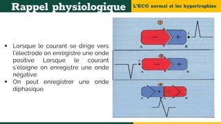 L’ECG normal et les hypertrophies
Rappel physiologique
 Lorsque le courant se dirige vers
l’électrode on enregistre une onde
positive Lorsque le courant
s’éloigne on enregistre une onde
négative
 On peut enregistrer une onde
diphasique.
 