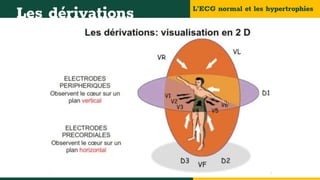 L’ECG normal et les hypertrophies
Les dérivations
 