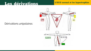 L’ECG normal et les hypertrophies
Les dérivations
Dérivations unipolaires
 