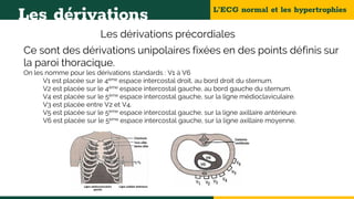 L’ECG normal et les hypertrophies
Les dérivations
Les dérivations précordiales
Ce sont des dérivations unipolaires fixées en des points définis sur
la paroi thoracique.
On les nomme pour les dérivations standards : V1 à V6
V1 est placée sur le 4ème espace intercostal droit, au bord droit du sternum.
V2 est placée sur le 4ème espace intercostal gauche, au bord gauche du sternum.
V4 est placée sur le 5ème espace intercostal gauche, sur la ligne médioclaviculaire.
V3 est placée entre V2 et V4.
V5 est placée sur le 5ème espace intercostal gauche, sur la ligne axillaire antérieure.
V6 est placée sur le 5ème espace intercostal gauche, sur la ligne axillaire moyenne.
 