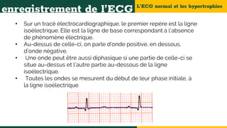 L’ECG normal et les hypertrophies
enregistrement de l’ECG
• Sur un tracé électrocardiographique, le premier repère est la ligne
isoélectrique. Elle est la ligne de base correspondant à l’absence
de phénomène électrique.
• Au-dessus de celle-ci, on parle d’onde positive, en dessous,
d’onde négative.
• Une onde peut être aussi diphasique si une partie de celle-ci se
situe au-dessus et l’autre partie au-dessous de la ligne
isoélectrique.
• Toutes les ondes se mesurent du début de leur phase initiale, à
la ligne isoélectrique
 