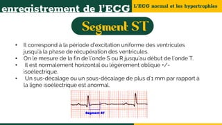 L’ECG normal et les hypertrophies
enregistrement de l’ECG
• Il correspond à la période d’excitation uniforme des ventricules
jusqu’à la phase de récupération des ventricules.
• On le mesure de la fin de l’onde S ou R jusqu’au début de l’onde T.
• Il est normalement horizontal ou légèrement oblique +/-
isoélectrique.
• Un sus-décalage ou un sous-décalage de plus d’1 mm par rapport à
la ligne isoélectrique est anormal.
 