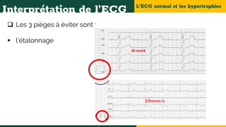 L’ECG normal et les hypertrophies
Interprétation de l’ECG
 Les 3 pièges à éviter sont :
 l’étalonnage
 