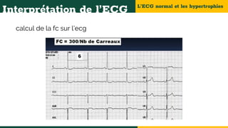 L’ECG normal et les hypertrophies
Interprétation de l’ECG
calcul de la fc sur l’ecg
 