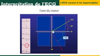 L’ECG normal et les hypertrophies
Interprétation de l’ECG
l’axe du coeur
 