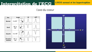 L’ECG normal et les hypertrophies
Interprétation de l’ECG
l’axe du coeur
 