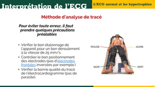 L’ECG normal et les hypertrophies
Interprétation de l’ECG
Méthode d'analyse de tracé
Pour éviter toute erreur, il faut
prendre quelques précautions
préalables
• Vérifier le bon étalonnage de
l’appareil pour un bon déroulement
à la vitesse de 25 mm/s.
• Contrôler le bon positionnement
des électrodes (pas d'électrodes
frontales inversées par exemple.)
• Vérifier la bonne qualité du tracé
de l’électrocardiogramme (pas de
parasite).
 