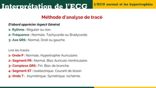 L’ECG normal et les hypertrophies
Interprétation de l’ECG
Méthode d'analyse de tracé
D'abord apprécier Aspect Général
1- Rythme : Régulier ou non.
2- Fréquence : Normale, Tachycarde ou Bradycarde.
3- Axe QRS : Normal, Droit ou gauche.
Lire les tracés
1- Onde P : Normale, Hypertrophie Auriculaire.
2- Segment PR : Normal, Bloc Auriculo-Ventriculaire.
3- Complexe QRS : Fin, Bloc de branche.
4- Segment ST : Isoélectrique, Courant de lésion.
5- Onde T : Asymétrique, Symétrique, Ischémie.
 