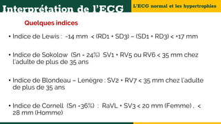 L’ECG normal et les hypertrophies
Interprétation de l’ECG
Quelques indices
• Indice de Lewis : -14 mm < (RD1 + SD3) – (SD1 + RD3) < +17 mm
• Indice de Sokolow (Sn = 24%) SV1 + RV5 ou RV6 < 35 mm chez
l’adulte de plus de 35 ans
• Indice de Blondeau – Lenègre : SV2 + RV7 < 35 mm chez l’adulte
de plus de 35 ans
• Indice de Cornell (Sn =36%) : RaVL + SV3 < 20 mm (Femme) , <
28 mm (Homme)
 