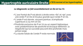 L’ECG normal et les hypertrophies
Hypertrophie auriculaire Droite
Le diagnostic se fait essentiellement en D2 et/ou V1
L’axe frontal de P est dévié à droite entre +60° et +90° avec
une onde P en D2 et D3 plus grande que l’onde P en D1.
L’onde P est élevée, souvent pointue, d’amplitude
supérieure à 2.5 mm en D2.
Positivité exclusive de P en V1 ou un aspect biphasique
avec prédominance de positivité et brusque déflexion, la
négativité qui lui succède pouvant être profonde mais
jamais large.
La durée totale de l’onde P reste normale.
 