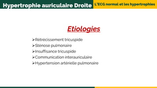 L’ECG normal et les hypertrophies
Etiologies
Rétrécissement tricuspide
Sténose pulmonaire
Insuffisance tricuspide
Communication interauriculaire
Hypertension artérielle pulmonaire
Hypertrophie auriculaire Droite
 