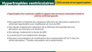 L’ECG normal et les hypertrophies
Hypertrophies ventriculaires
L’hypertrophie d’un ventricule modifie le rapport entre la masse ventriculaire droite et
celle du ventricule gauche.
Elle augmente l’amplitude des complexes QRS dans les dérivations explorant le
ventricule hypertrophié avec modification de l’axe de QRS
Elle retarde modérément l’apparition de la déflexion intrinsécoïde dans les
dérivations qui font face à ce ventricule.
Elle allonge modérement la durée de QRS.
La durée du QT est modérement allongée.
Elle peut s’accompagner de modifications de la repolarisation (ST et T) dans les
même dérivations : Troubles secondaires de la repolarisation.
 