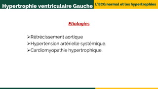 L’ECG normal et les hypertrophies
Hypertrophie ventriculaire Gauche
Etiologies
Rétrécissement aortique
Hypertension artérielle systémique.
Cardiomyopathie hypertrophique.
 