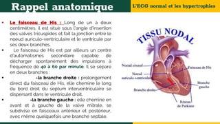 L’ECG normal et les hypertrophies
Rappel anatomique
 Le faisceau de His : Long de un à deux
centimètres, il est situé sous l'angle d'insertion
des valves tricuspides et fait la jonction entre le
noeud auriculo-ventriculaire et le ventricule par
ses deux branches.
 Le faisceau de His est par ailleurs un centre
d'automatismes secondaire capable de
décharger spontanément des impulsions à
fréquence de 40 à 60 par minute. Il se sépare
en deux branches :
 -la branche droite : prolongement
direct du faisceau de His, elle chemine le long
du bord droit du septum interventriculaire se
dispersant dans le ventricule droit.
 -la branche gauche : elle chemine en
avant et à gauche de la valve mitrale, se
subdivise en faisceaux antérieur et postérieur,
avec même quelquefois une branche septale.
 