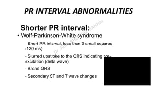 Short Pri ECG ( Electrocardiogram) | PPT