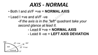 ECG ( Electrocardiogram) | PPT