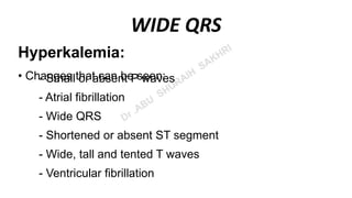ECG ( Electrocardiogram) | PPT