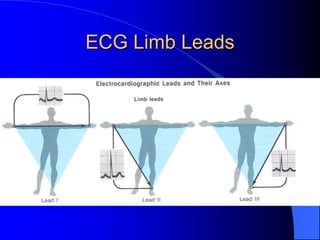 ECG Limb Leads
 