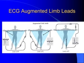 ECG Augmented Limb Leads
 