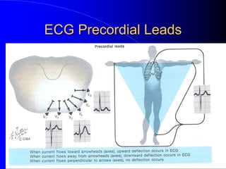 ECG Precordial Leads
 