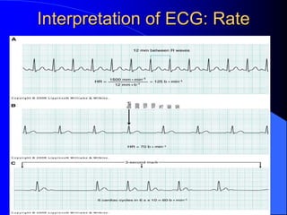 Interpretation of ECG: Rate
 